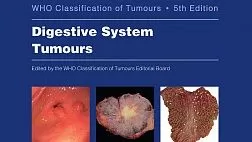 Классификация опухолей желудочно-кишечного тракта ВОЗ 2019, пятое издание.