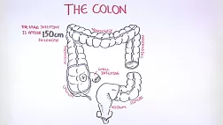 Видео: анатомия толстой кишки, механизм развития колоректального рака толстой кишки