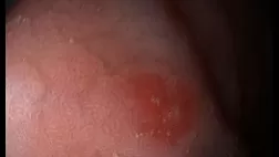 Клинический случай МегаМарофон  2025 