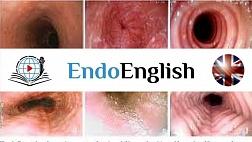 Eosinophilic Esophagitis. МЕДИЦИНСКИЙ АНГЛИЙСКИЙ
